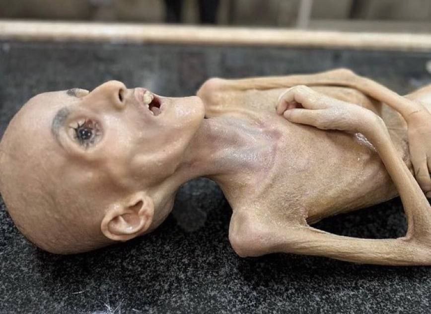 ক্ষুধার্ত হয়ে মারা যায় এক শিশু